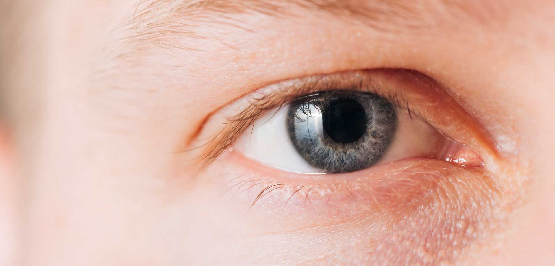 Does eyes. Трансплантация глаз у человека. Заболевание глаза н 11.9