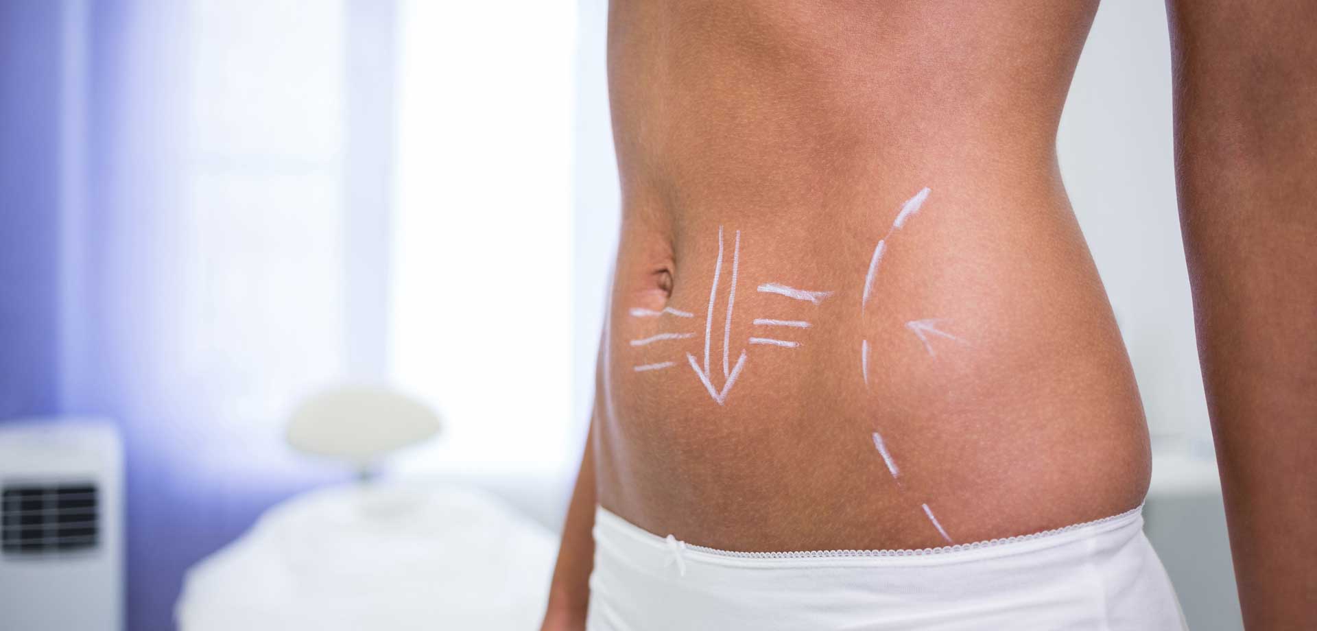 female-liposuction-plastic-surgery-office