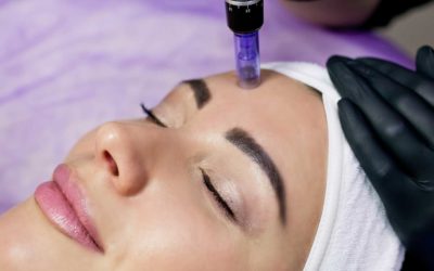 Is Microneedling Painful?
