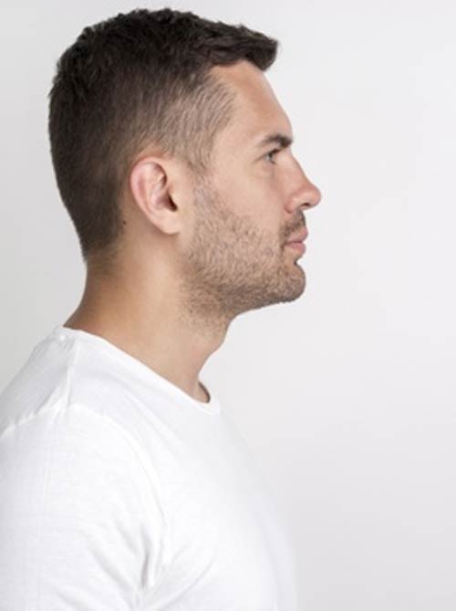 The-Woodlands-Plastic-Surgery-Medspa-male-injuries-rhinoplasty-nose-job-conroe-cypress-kingwood-spring-humble-texas-03