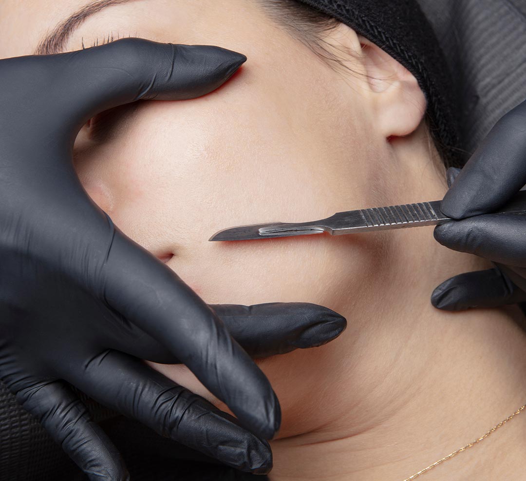 Dermaplane